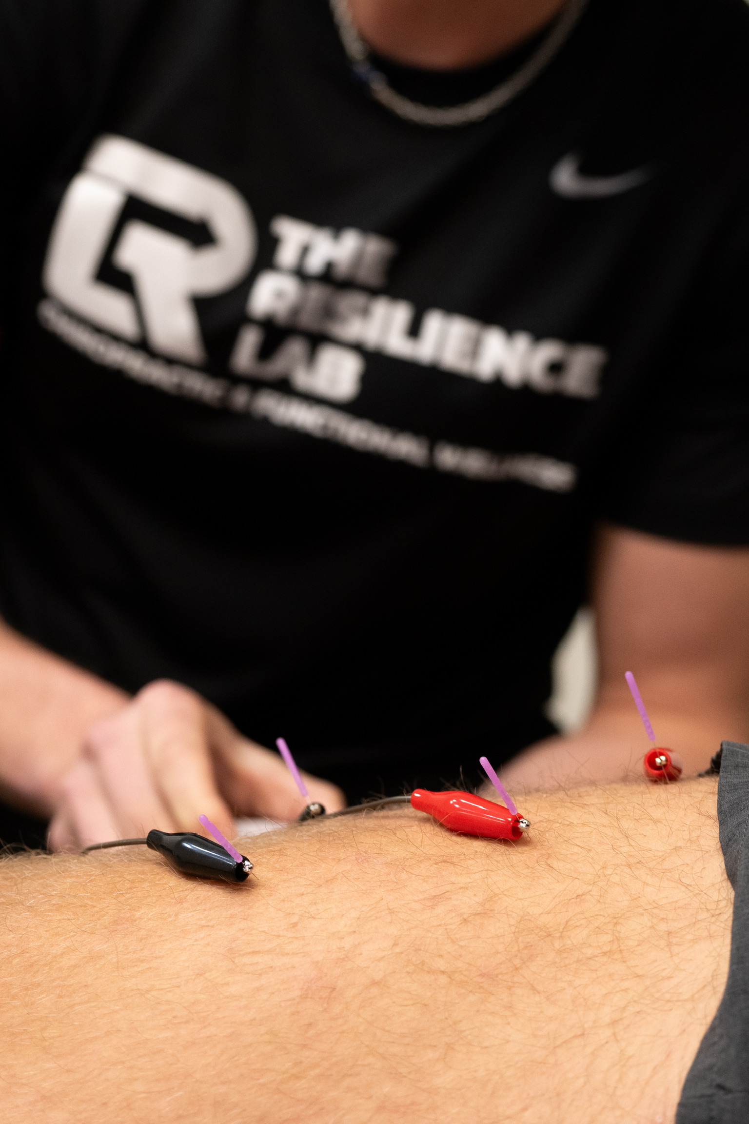 Close-up of needles or clinical hands-on treatment